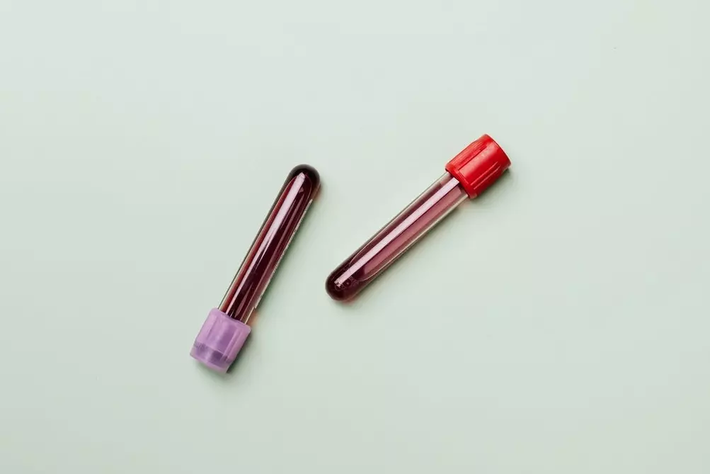 Hematološka laboratorija Sarajevo | HBL LABORATORIJA